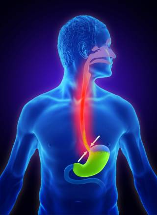 Artykuł: Zgaga - czym jest i jak powstaje