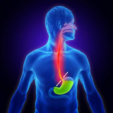 Zgaga - czym jest i jak powstaje