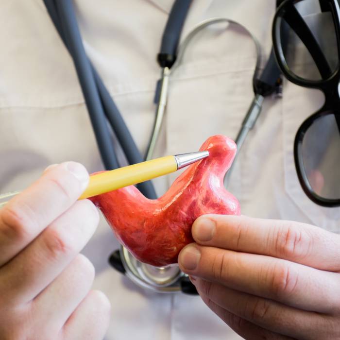 Zwieracz przełyku. Jak wzmocnić jego napięcie i usprawnić działanie?