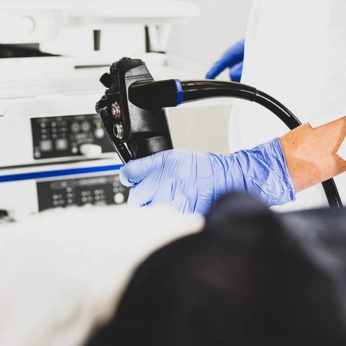 Gastroskopia - na czym polega, jak się do niej przygotować i czy jest konieczna w chorobie refluksowej?